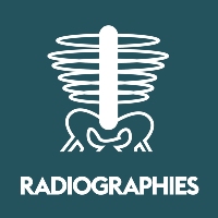 Radiographies